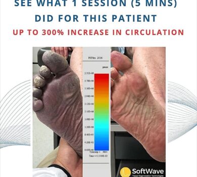 softwave-therapy-is-great-for-improving-circulation